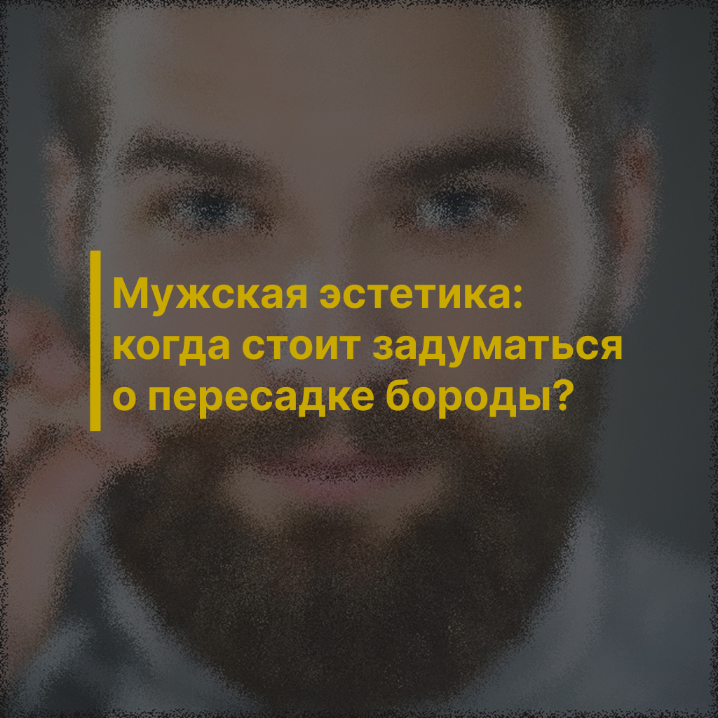 Мужская эстетика: когда стоит задуматься о пересадке бороды?