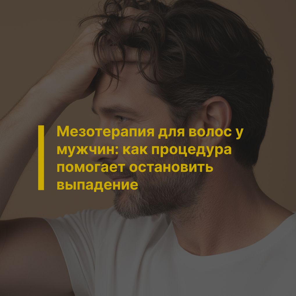 Мезотерапия для волос у мужчин: как процедура помогает остановить выпадение