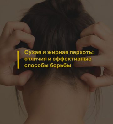 Сухая и жирная перхоть: отличия и эффективные способы борьбы