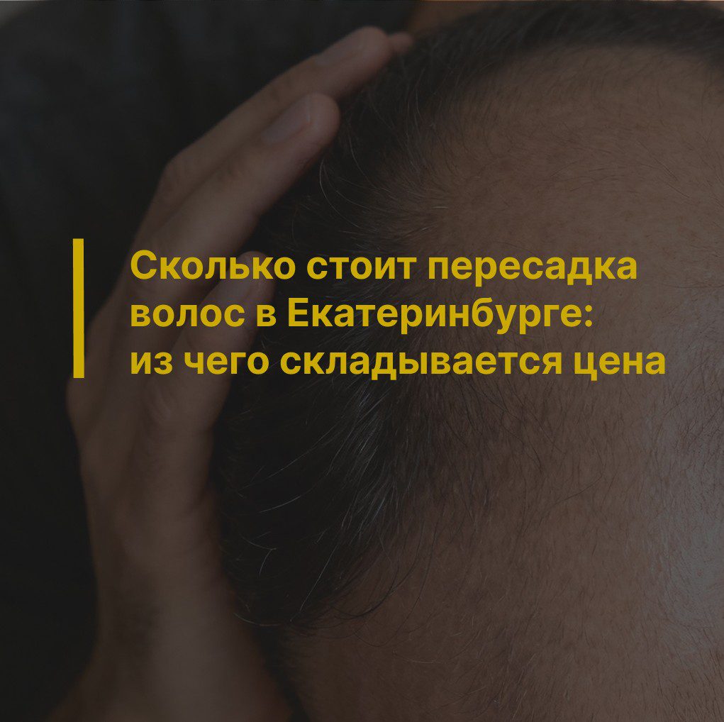Сколько стоит пересадка волос в Екатеринбурге: из чего складывается цена