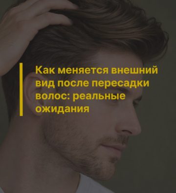 Как меняется внешний вид после пересадки волос: реальные ожидания