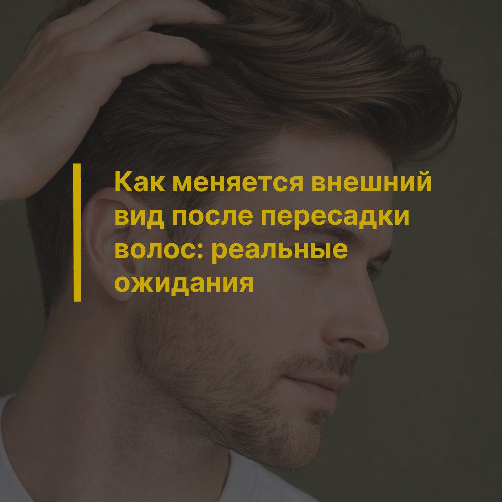 Как меняется внешний вид после пересадки волос: реальные ожидания