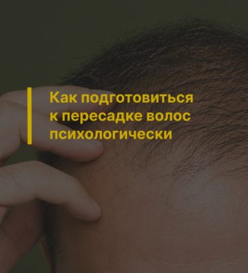 Как подготовиться к пересадке волос психологически
