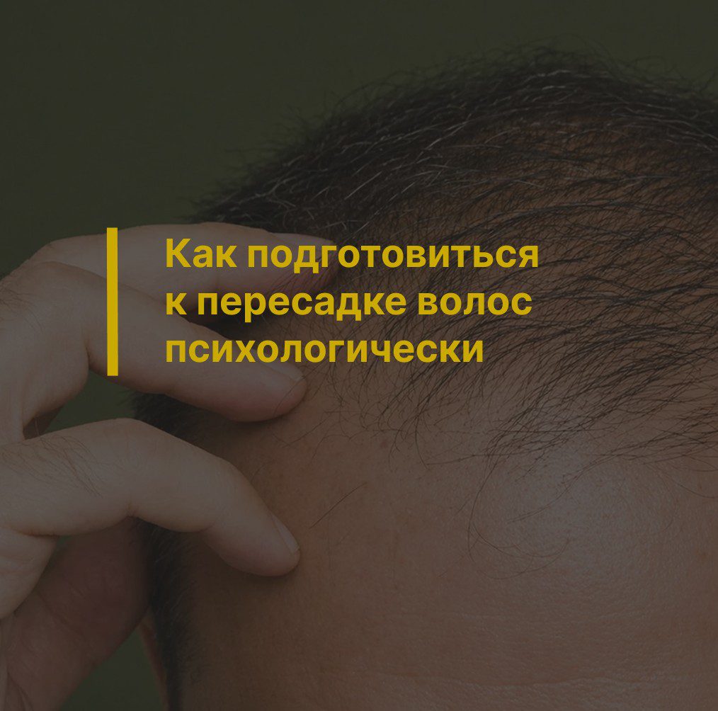 Как подготовиться к пересадке волос психологически