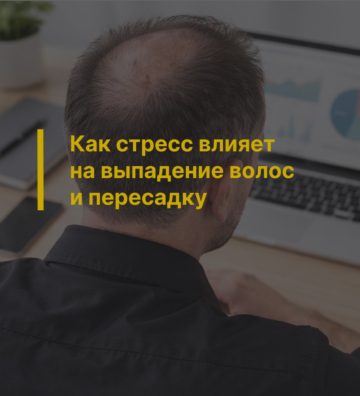 Как стресс влияет на выпадение волос и пересадку