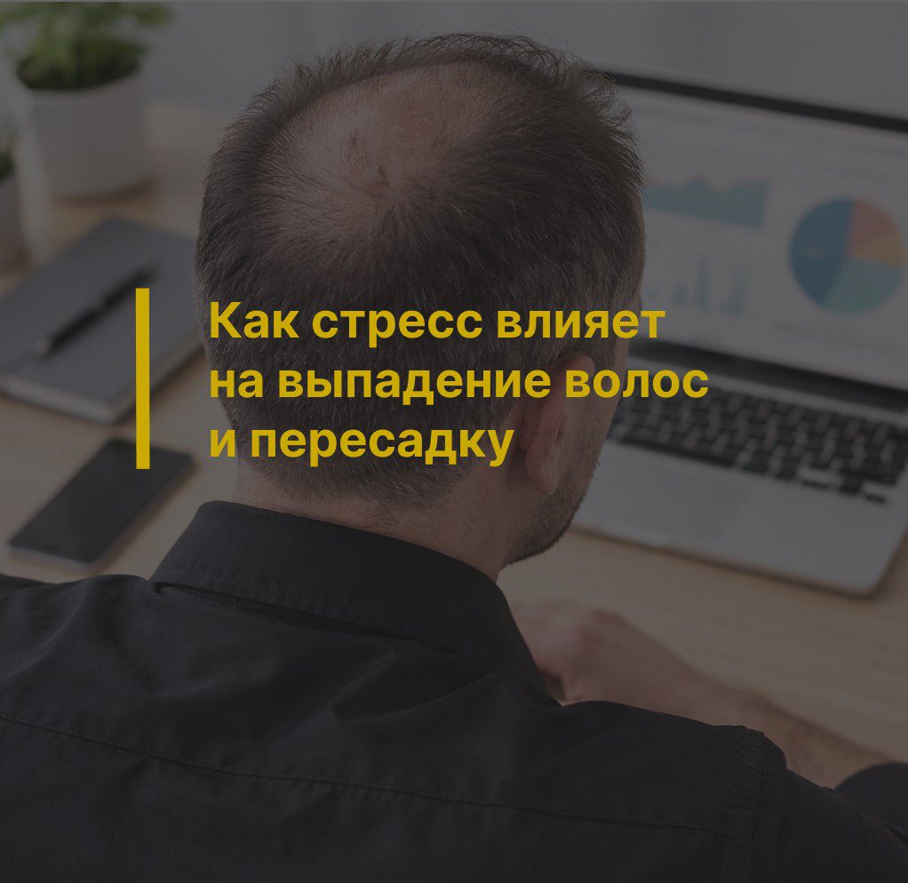 Как стресс влияет на выпадение волос и пересадку