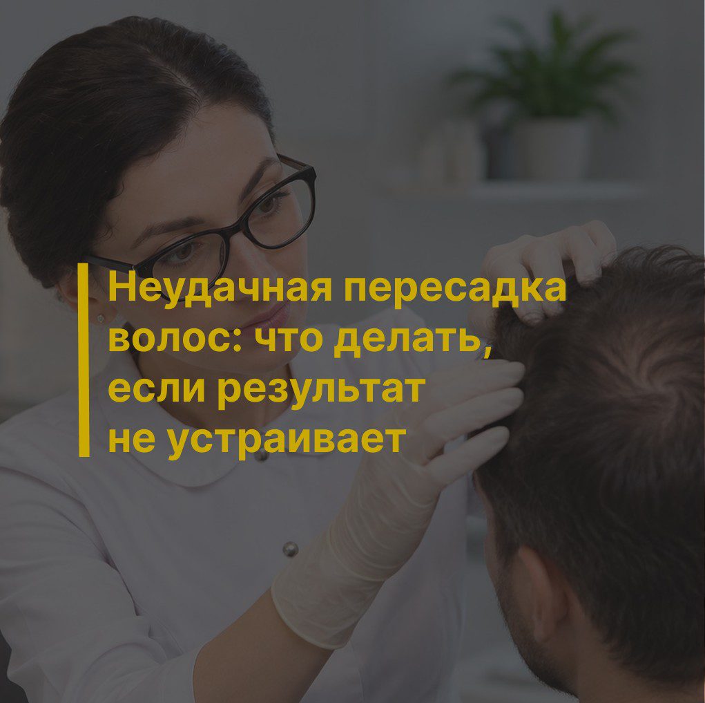 Неудачная пересадка волос: что делать, если результат не устраивает