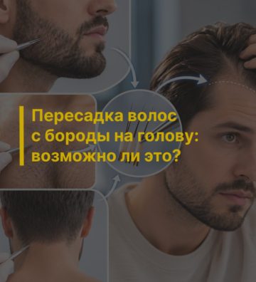 Пересадка волос с бороды на голову: возможно ли это?